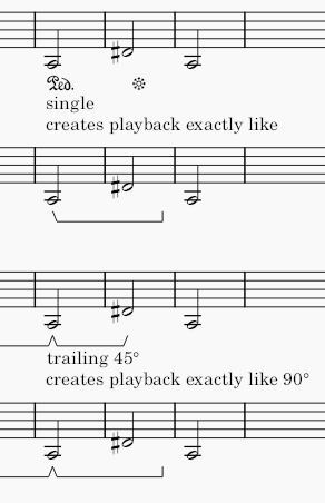 ms4p_type1_playback_singletrailing.PNG
