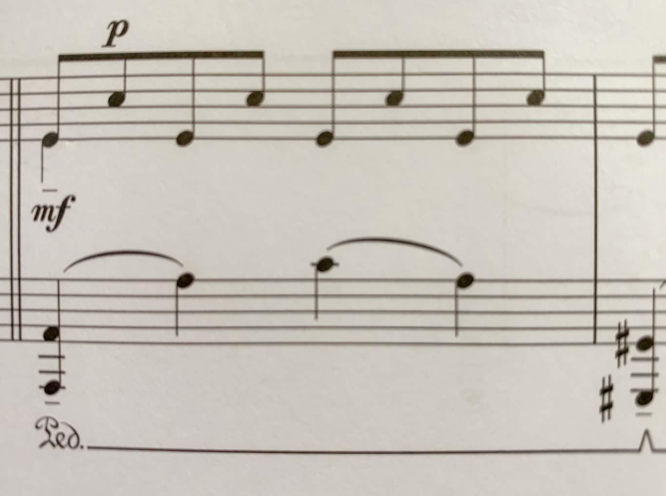 Four MuseScore notation questions | MuseScore