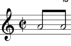 Eighth notes with half note heads [please help] | MuseScore